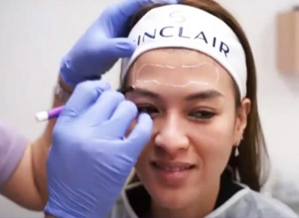 Webinar The Secret of Facial Rejuvenation with European Collagen Stimulating Filler